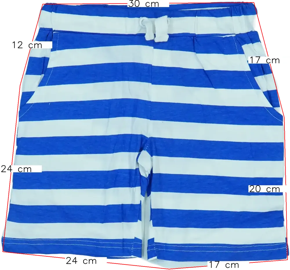 Többszínű Overkids Rövidnadrág EU 116 / UK 6 év / US 6 év/S