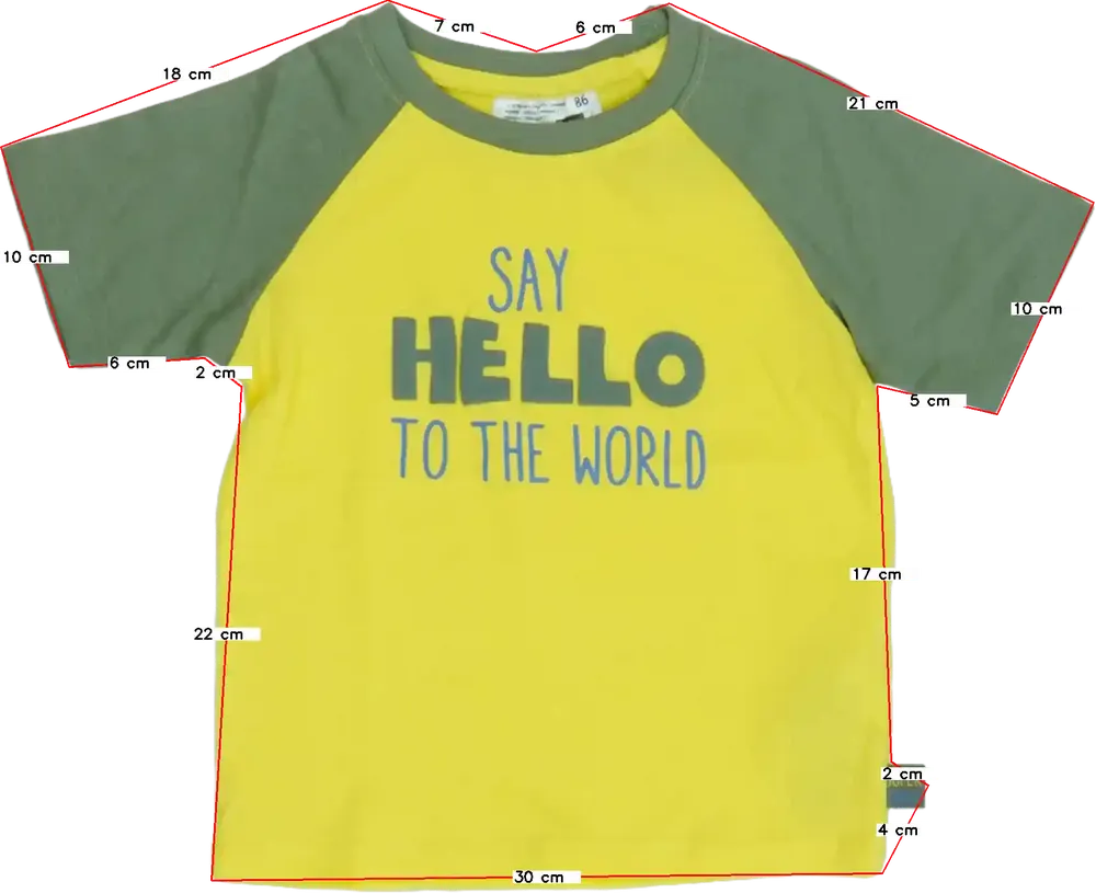 Sárga Ergee Póló EU 86 / UK 12-18 hónap / US 18 hónap