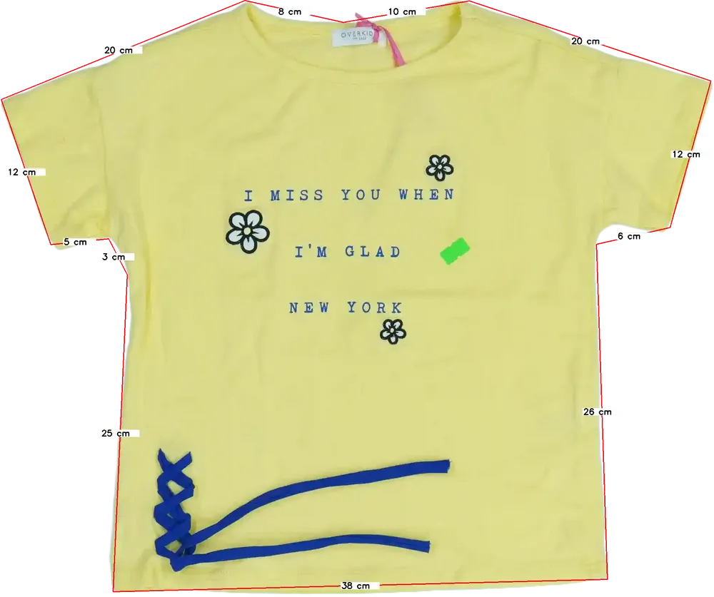 Sárga Overkids Póló EU 122 / UK 7 év / US 7 év/M